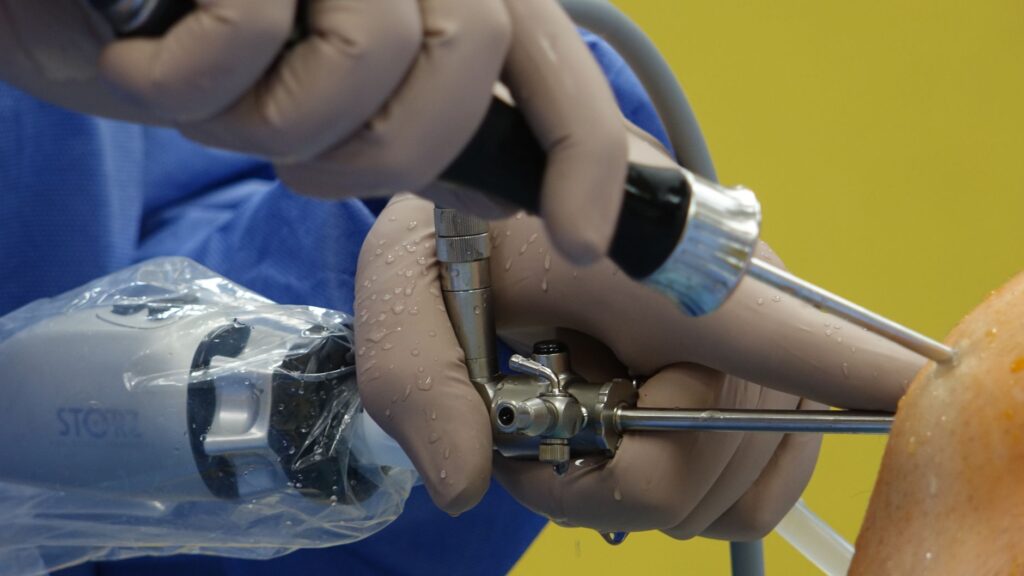 Arthroscopic Management Of Peroneal Tendon Tears: New Techniques And Tools For Better Repair With Dr. Phinit Phisitkul Dakota Dunes, SD