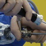 Orthopedic surgeon performing arthroscopic ankle surgery on peroneal tendon