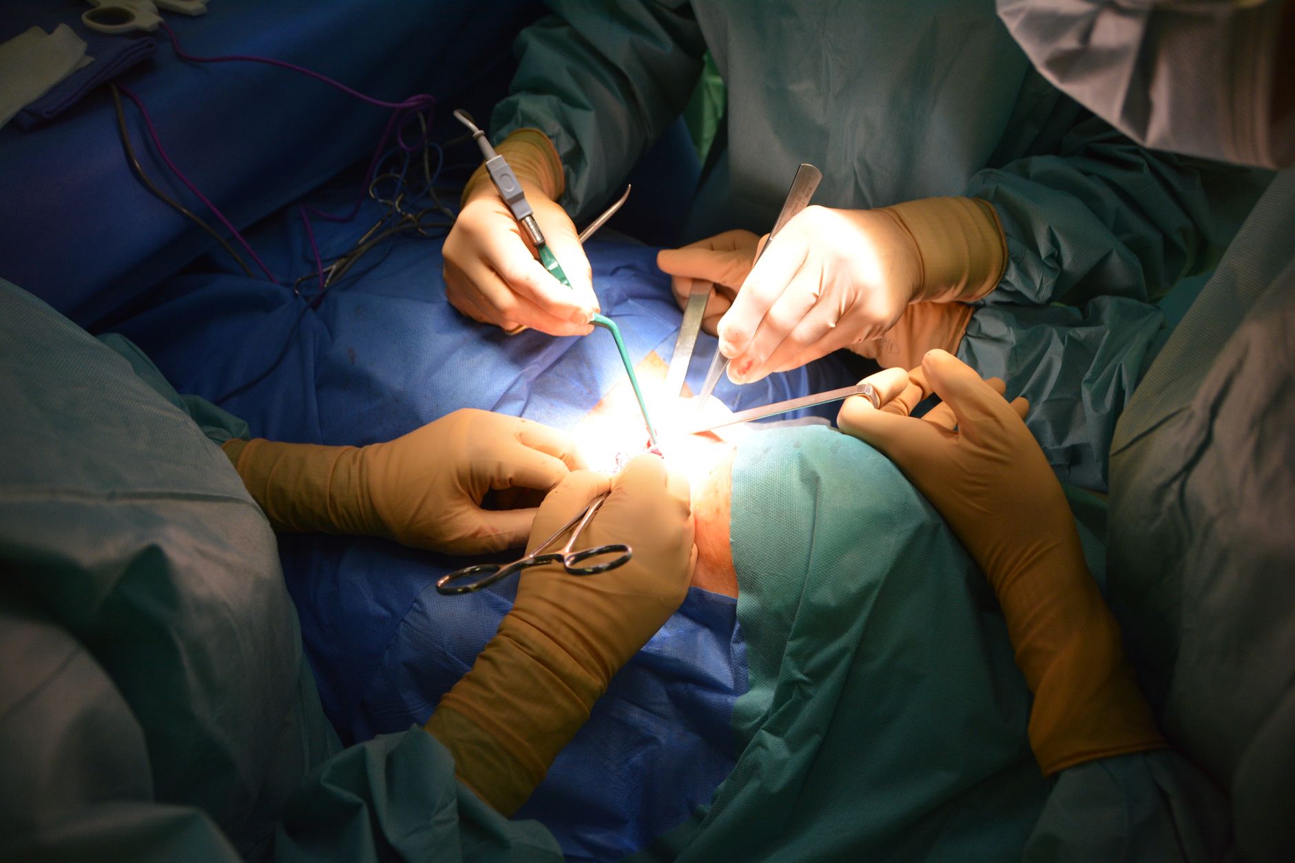 Surgeon performing cardiovascular heart surgery in operating room with medical equipment