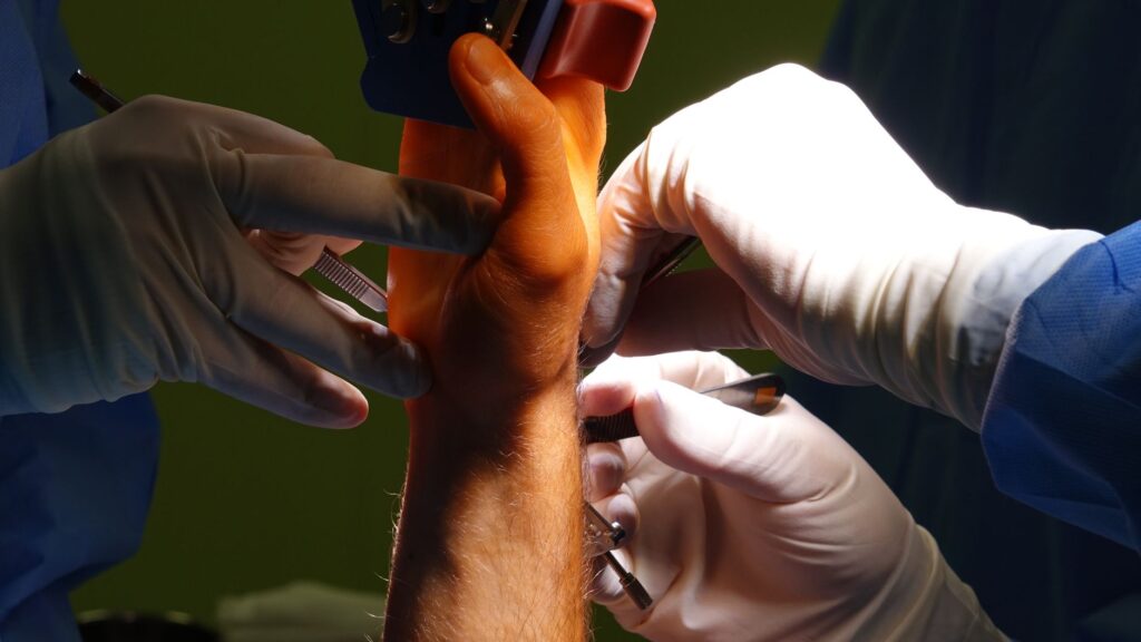 Enhancing Movement Through Wrist Surgery from Dr. Yorell Manon-Matos